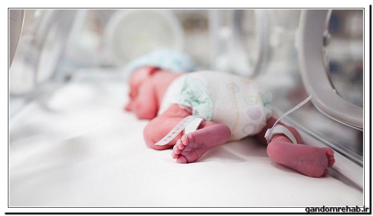 آیا نوزادان نارس می‌توانند طبیعی شوند؟